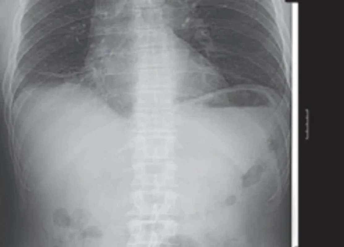  / Fig. 2.