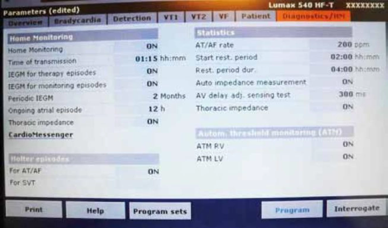 Aktivace služby Biotronik Home Monitoring během ambulantní kontroly.
Položka Home Monitoring (zapnutí, čas odesílání „trendových“ dat, odesílání IEGM epizod, odesílání IEGM monitorovaných epizod, odesílání periodického IEGM, definice délky dlouhé síňové epizody, měření hrudní impedance), položka Holter Episodes (odesílání informací o síňových arytmiích a arytmiích v zóně VT hodnocené jako supraventrikulární), položka Statistics (nastavení síňové frekvence pro definici síňové arytmie, definice klidového období, automatické měření impedance, nastavení testovacího AV delay pro měření amplitudy komplexů QRS, hodnocení údajů hrudní impedance), položka ATM (automatické měření prahu na pravo- a levokomorové elektrodě).