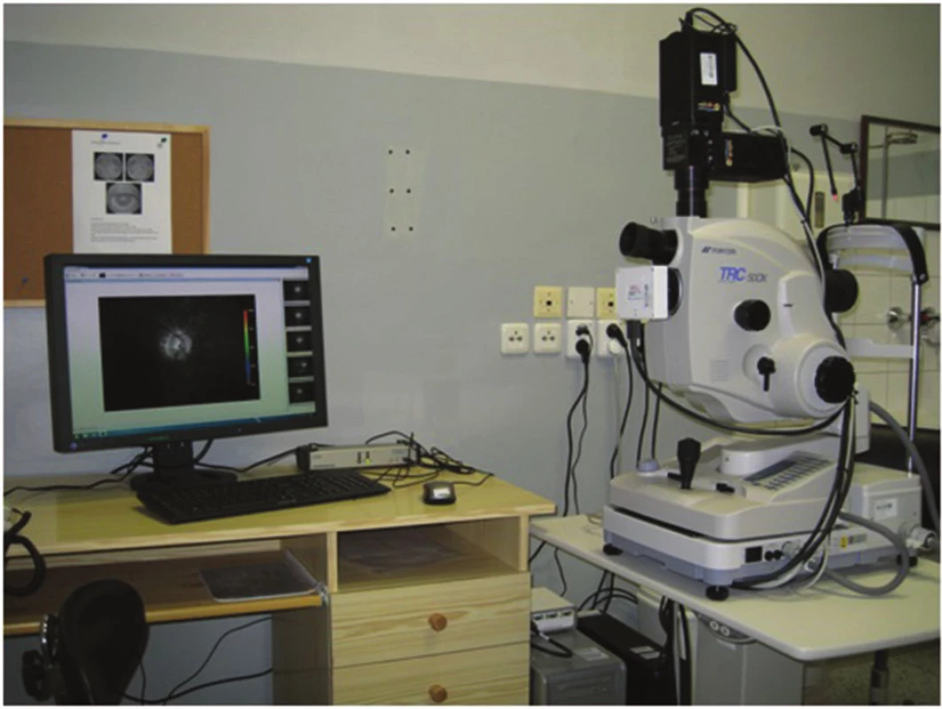 Duální neinvazivní retinální oxymetr T1 (Oxymap ehf. Rejkjavík, Iceland) připojený na standardní funduskameru (Topcon, TRC – 50 DX, Topcon corp. Tokio, Japan)