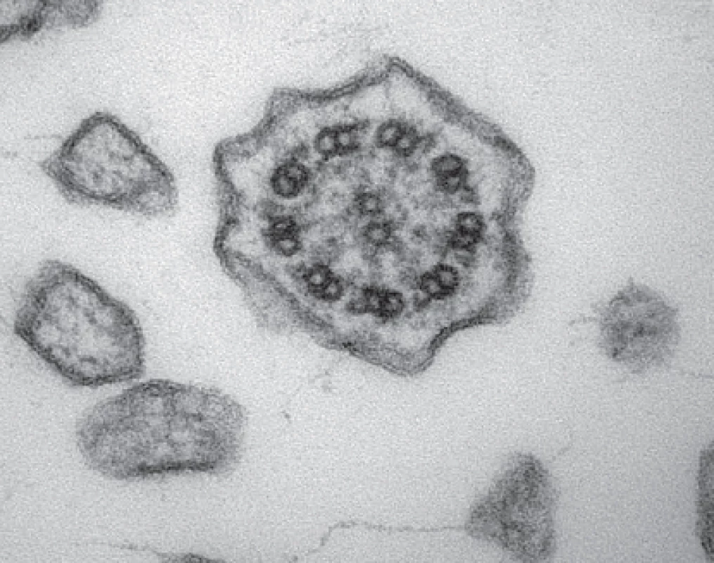 Transmisní elektronová mikroskopie – řasinka s normální ultrastrukturou.
Fig. 3. Transmission electron microscopy – cilium with normal ultrastructure.