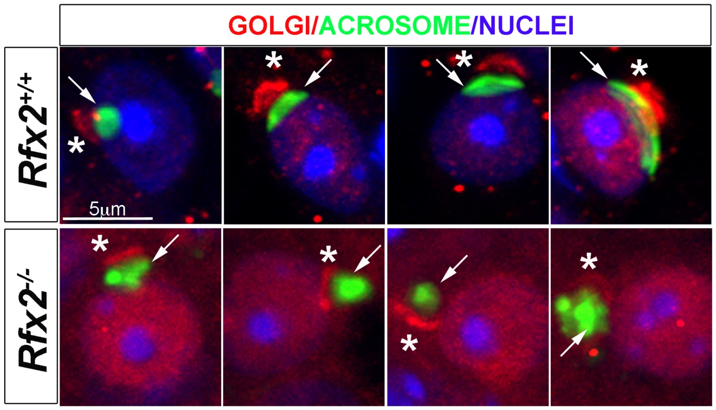 Testis sections from P30 <i>Rfx2</i><sup>+/+</sup> or <i>Rfx2</i><sup><i>-/-</i></sup> mice stained for the cis-Golgi compartment (GM130 antibody, red), the acrosome (peanut agglutinin, green) or nuclei (Dapi, blue).
