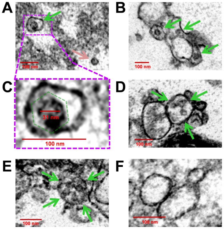 Virions were identified inside purified EMVs by transmission electron microscopy.