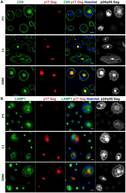 In the absence of Vpu, HIV accumulates in IPMCs.