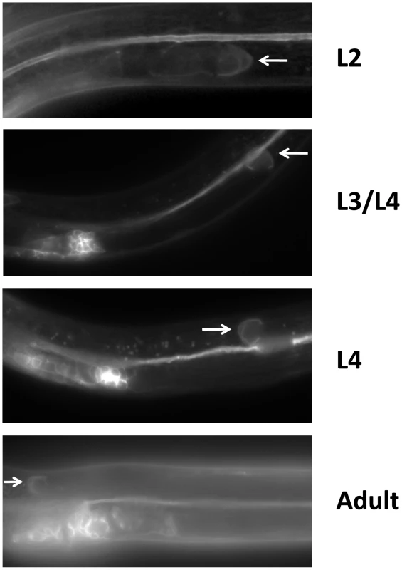 LIN-17 is expressed in the hermaphrodite DTCs throughout development.