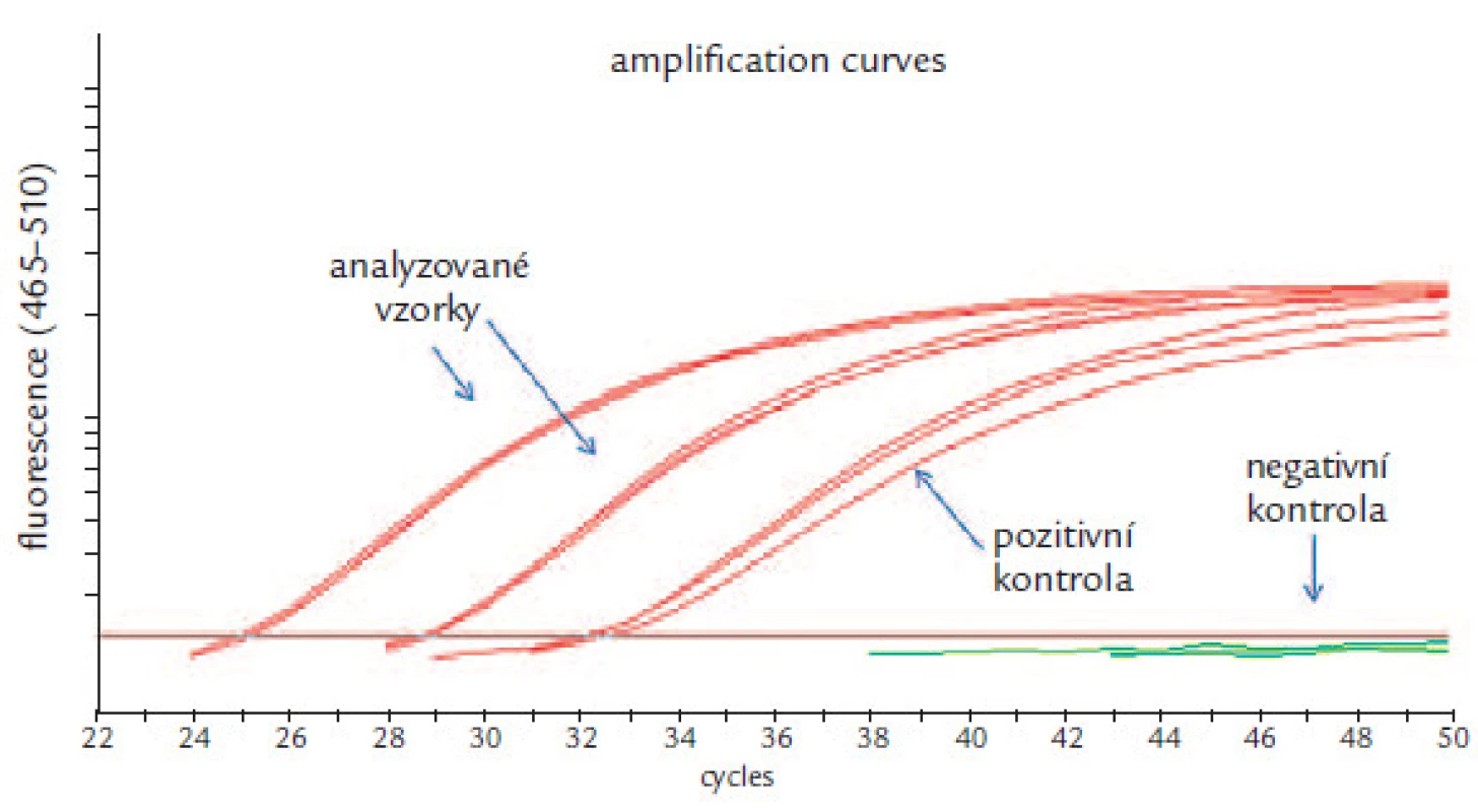 Analýza genu SEPT9: dva amplifikované vzorky, pozitivní a negativní kontrola.