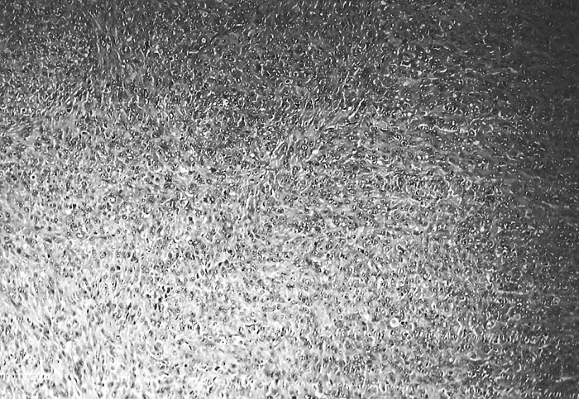 jp_1526_p_3