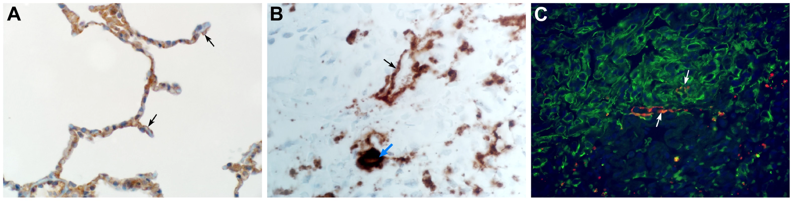 The cellular tropism of MERS-CoV.