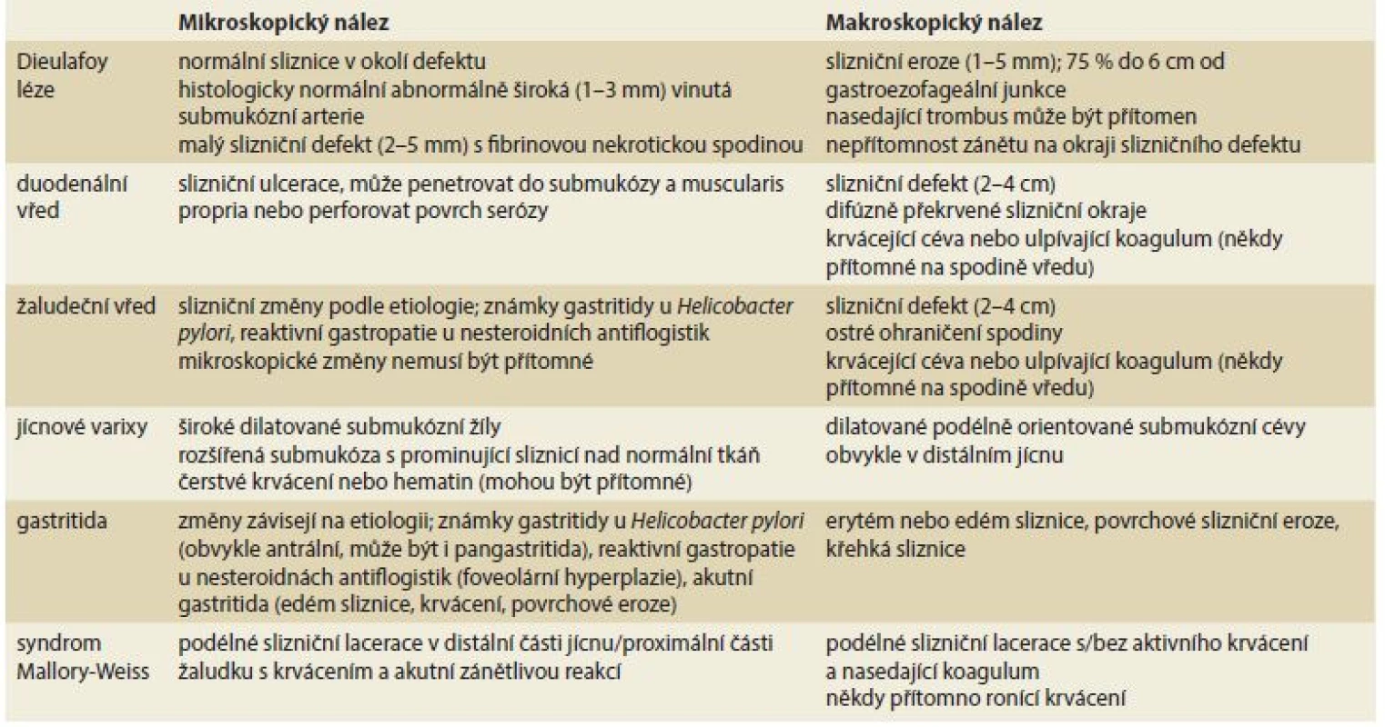 Diferenciální diagnostika krvácení z horní části gastrointestinálního traktu podle Clements et al [3].
Tab. 1. Difeerential diagnosis of upper gastrointestinal bleeding according to Clements et al [3].