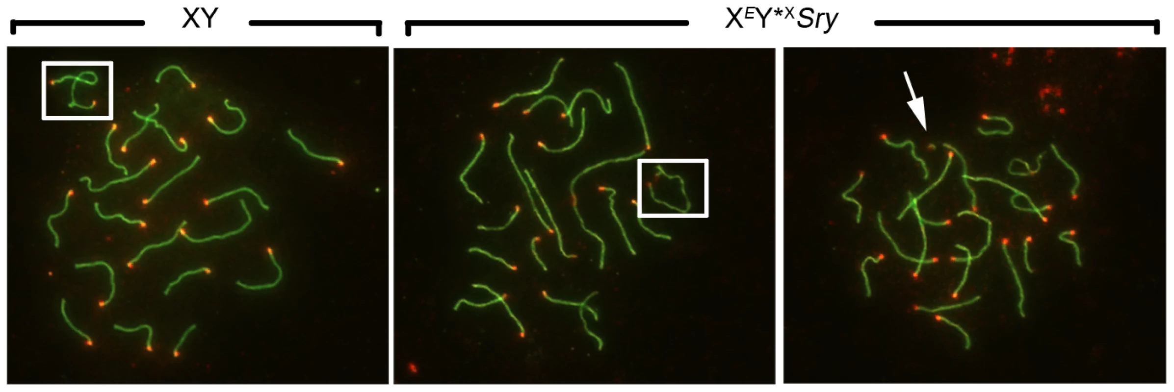 Efficiency of XY synapsis in the XY*<sup>X</sup> males with varying Yp complements.