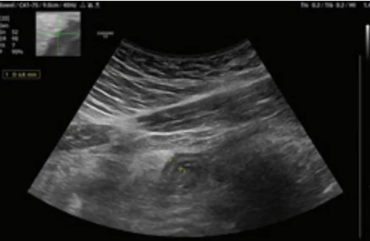  / Fig. 3.