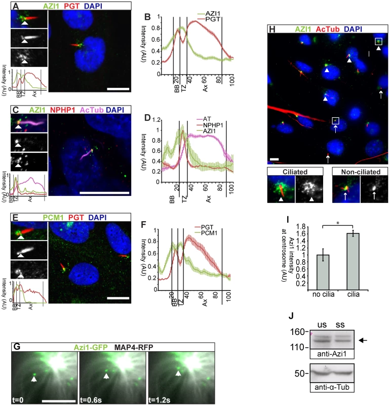Azi1 localises to centriolar satellites and the transition zone, and traffics along microtubules.