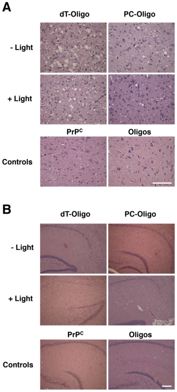 Representative histological fields of brainstem and hippocampus.