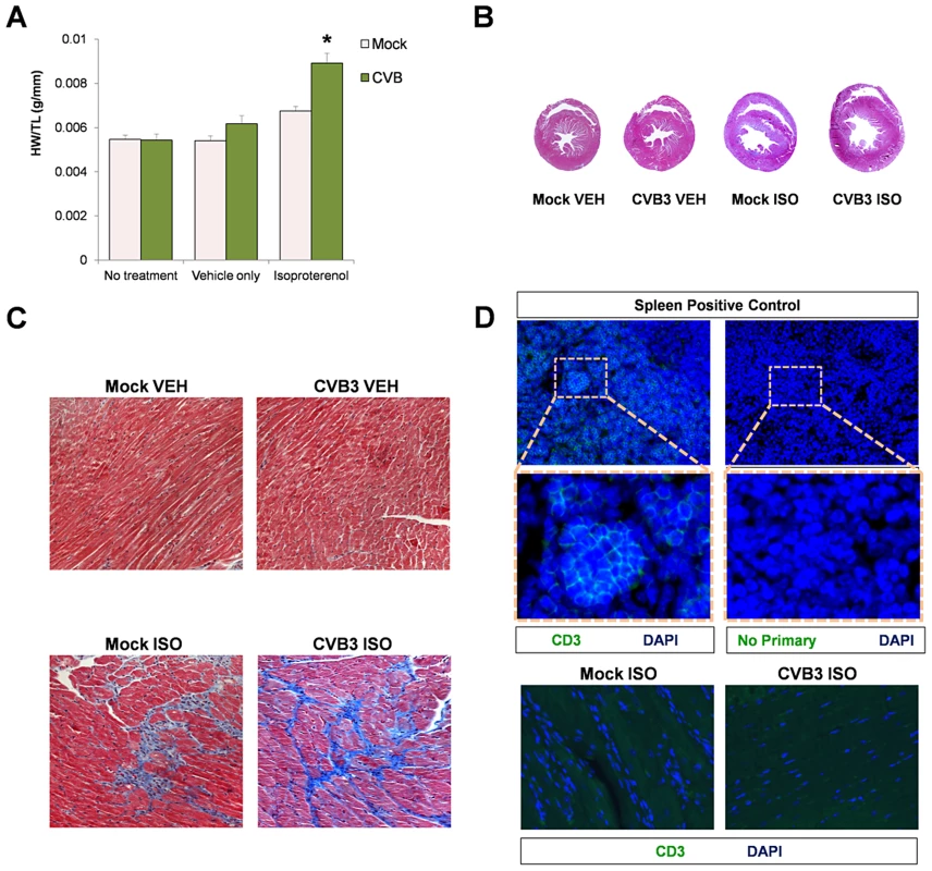 Beta-adrenergic stimulation-induced cardiac hypertrophy in adult mice infected with CVB3 at an early age leads to dilated cardiomyopathy.