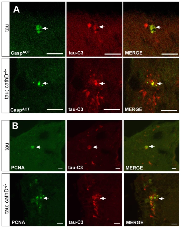 Truncated tau co-localizes with markers of cellular injury.
