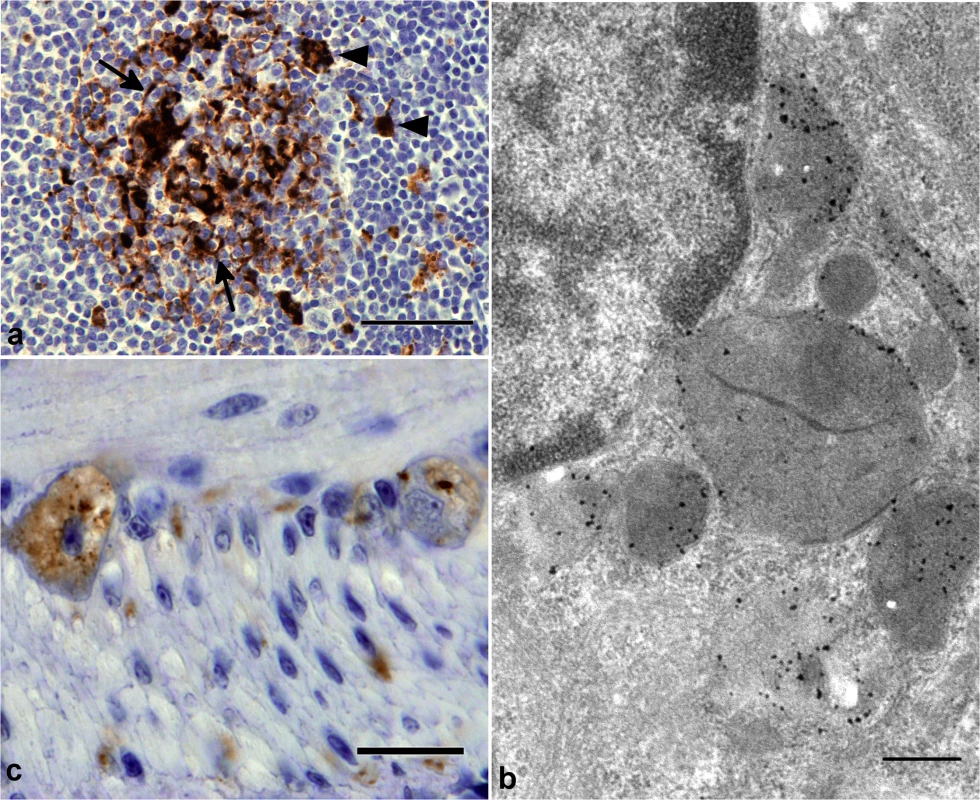 PrP-d accumulation in viscera of CD-1 mice i.p. challenged with rec-Prions.