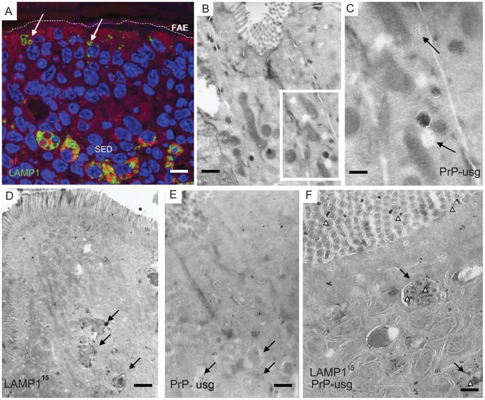 Subcellular localization of neurofilament and PrP uptake in FAE and SED.