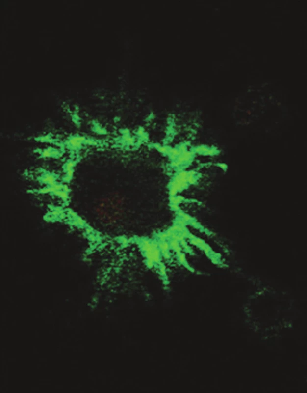 Typická morfologie DC při značení povrchovou protilátkou proti CD80 a pozorování v konfokálním mikroskopu
Fig. 1. Typical DC morphology upon marking with anti- CD80 superficial antibody, observed using a confocal microscope
