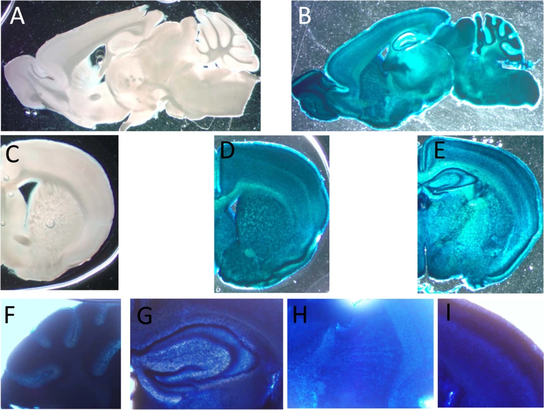 Expression of CaM KMT in the brain of adult C57Bl mice.