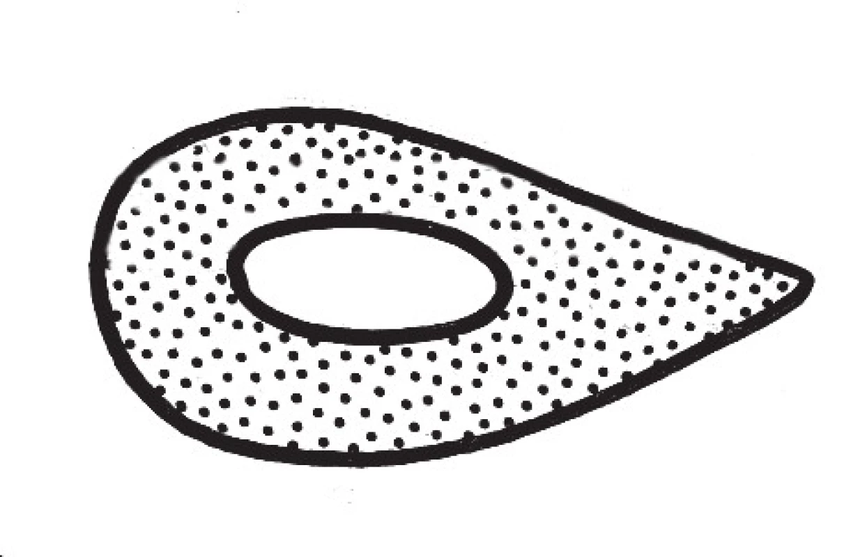 Průřez pravým radiem
Fig. 3: Right radius cross-section