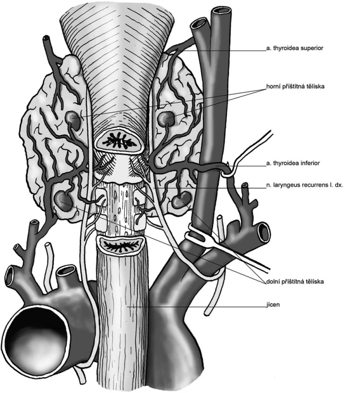 Příštítná tělíska v typické lokalizaci
Pic. 1. Parathyroids in a typical location