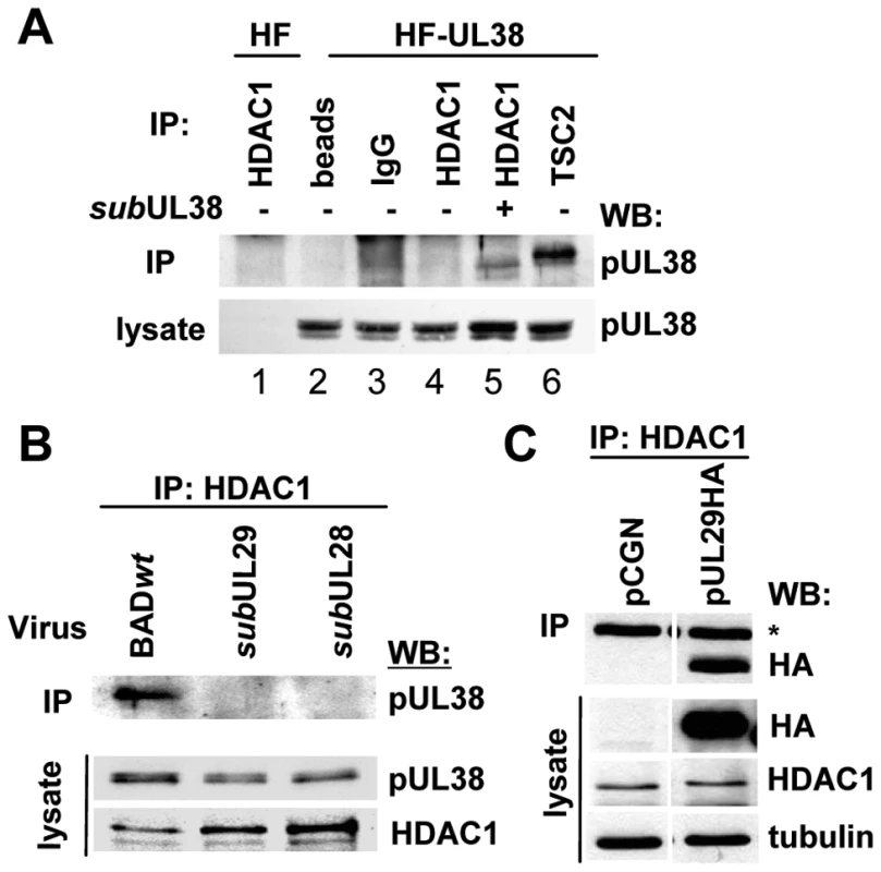 HCMV pUL29/28 is necessary for the HDAC1 interaction with pUL38.