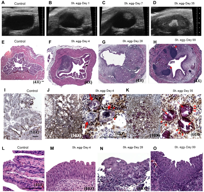 Bladder wall injection of <i>S. haematobium</i> eggs results in synchronous granuloma formation.