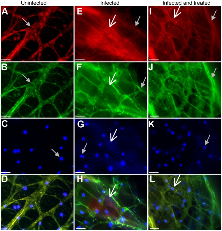 <i>In vivo P. aeruginosa</i> biofilms stain positively for EPS and DNA.