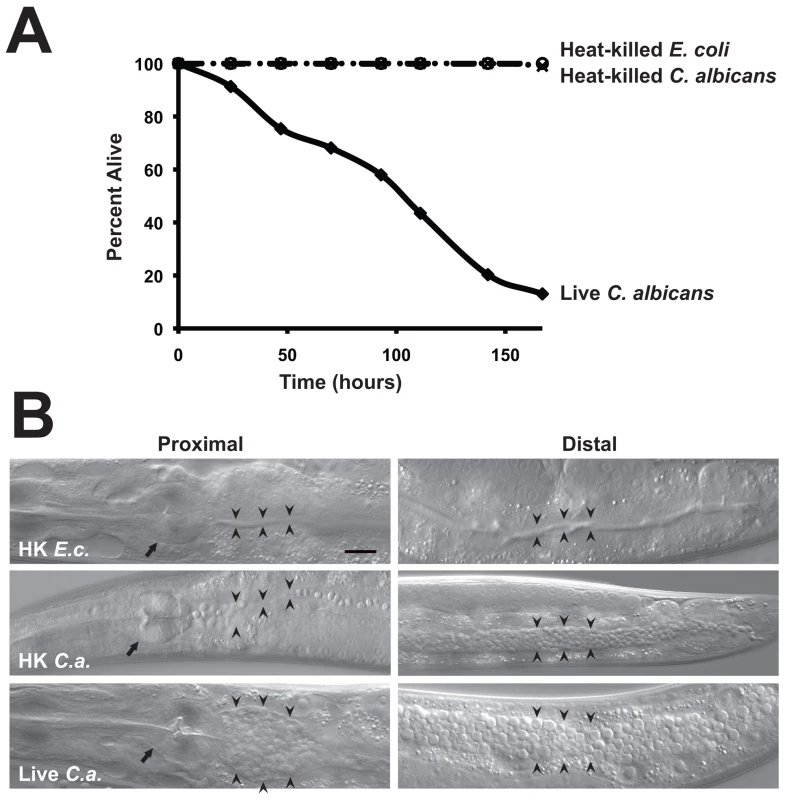 <i>C. albicans</i> yeast can kill <i>C. elegans</i>.