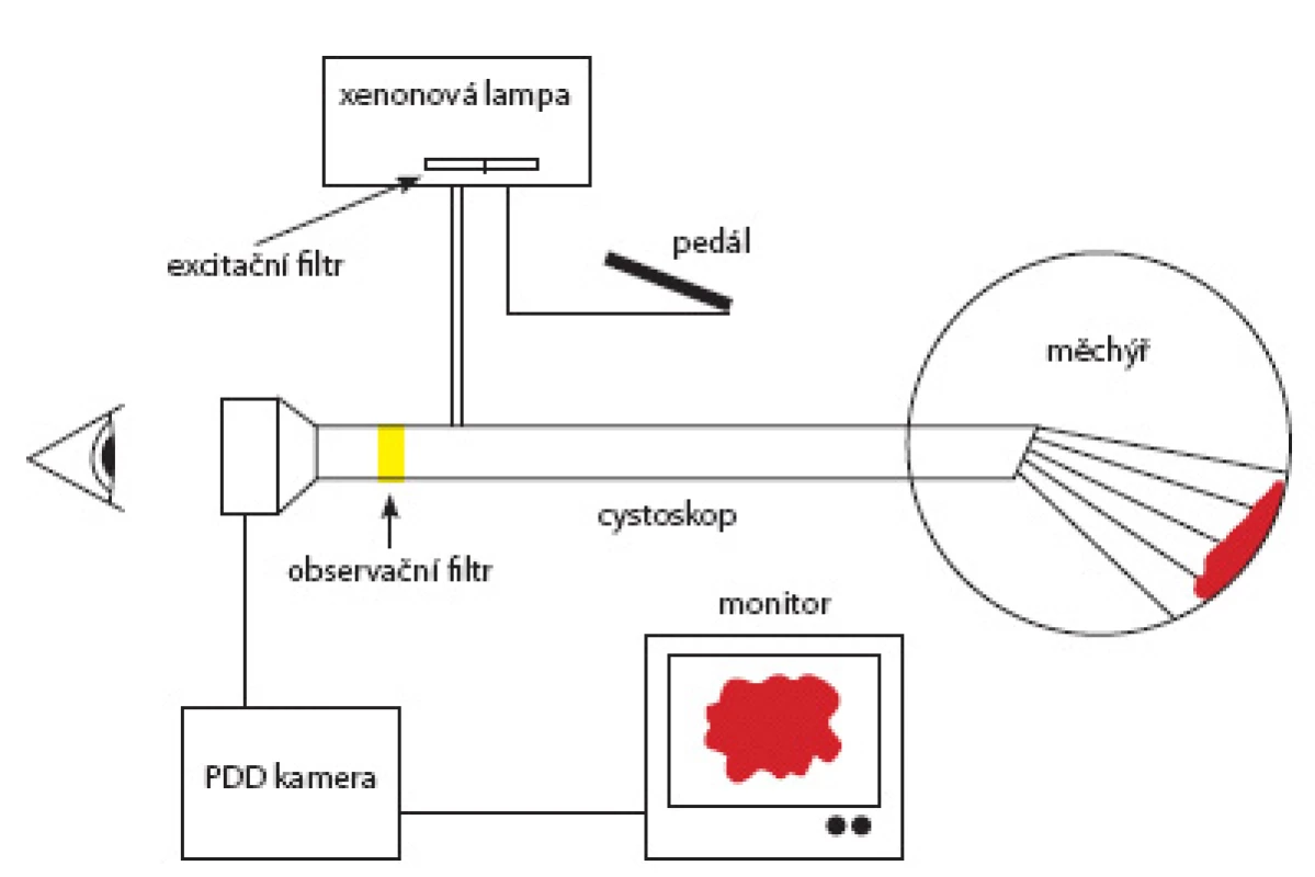 Princip zapojení fluorescenční cystoskopie
Fig. 1. Principle of fluorescent cystoscopy set up