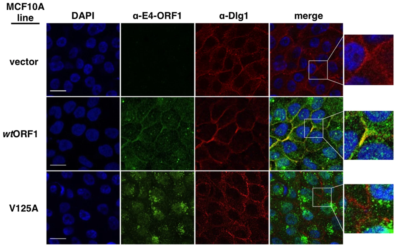 Dlg1 in the ternary complex recruits E4-ORF1 to the plasma membrane.