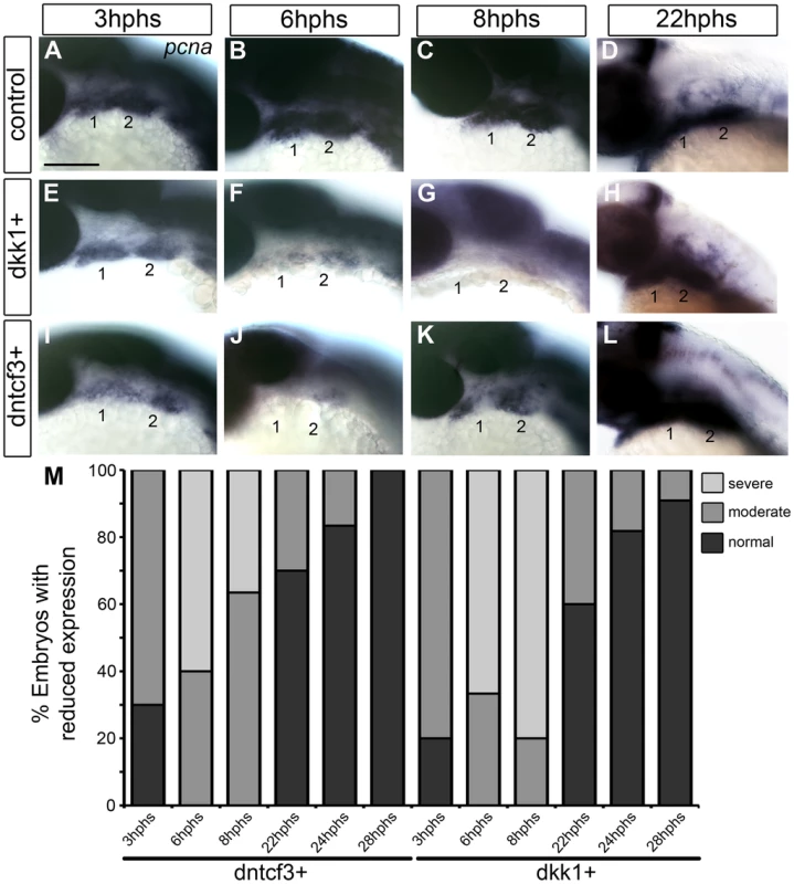 Requirements for Wnt signaling in pharyngeal arch cell proliferation.