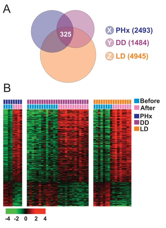 Hepatic injury and regeneration gene expression signature from human liver.