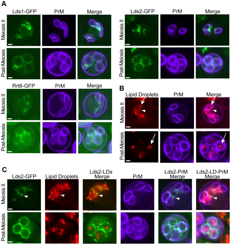 Localization of the Lds proteins involved in outer spore wall synthesis.