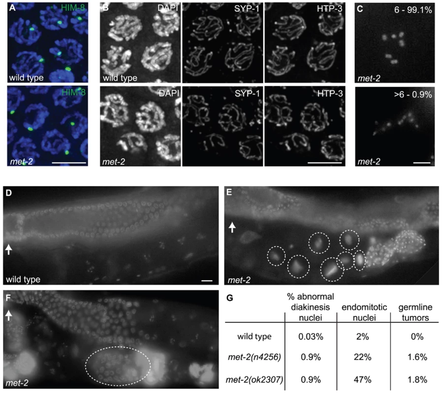 <i>met-2</i> phenotypes in the hermaphrodite gonad.