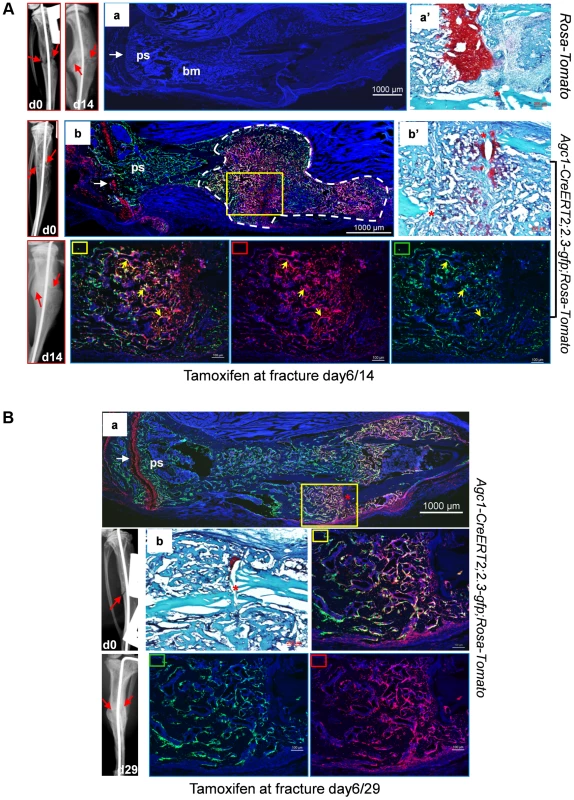 Osteoblasts derived from mature chondrocytes in the repair callus are involved in bone fracture healing.