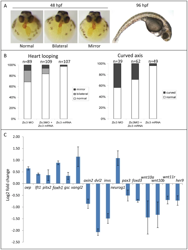 Zebrafish phenotype as a result of Zic3 knock-down.