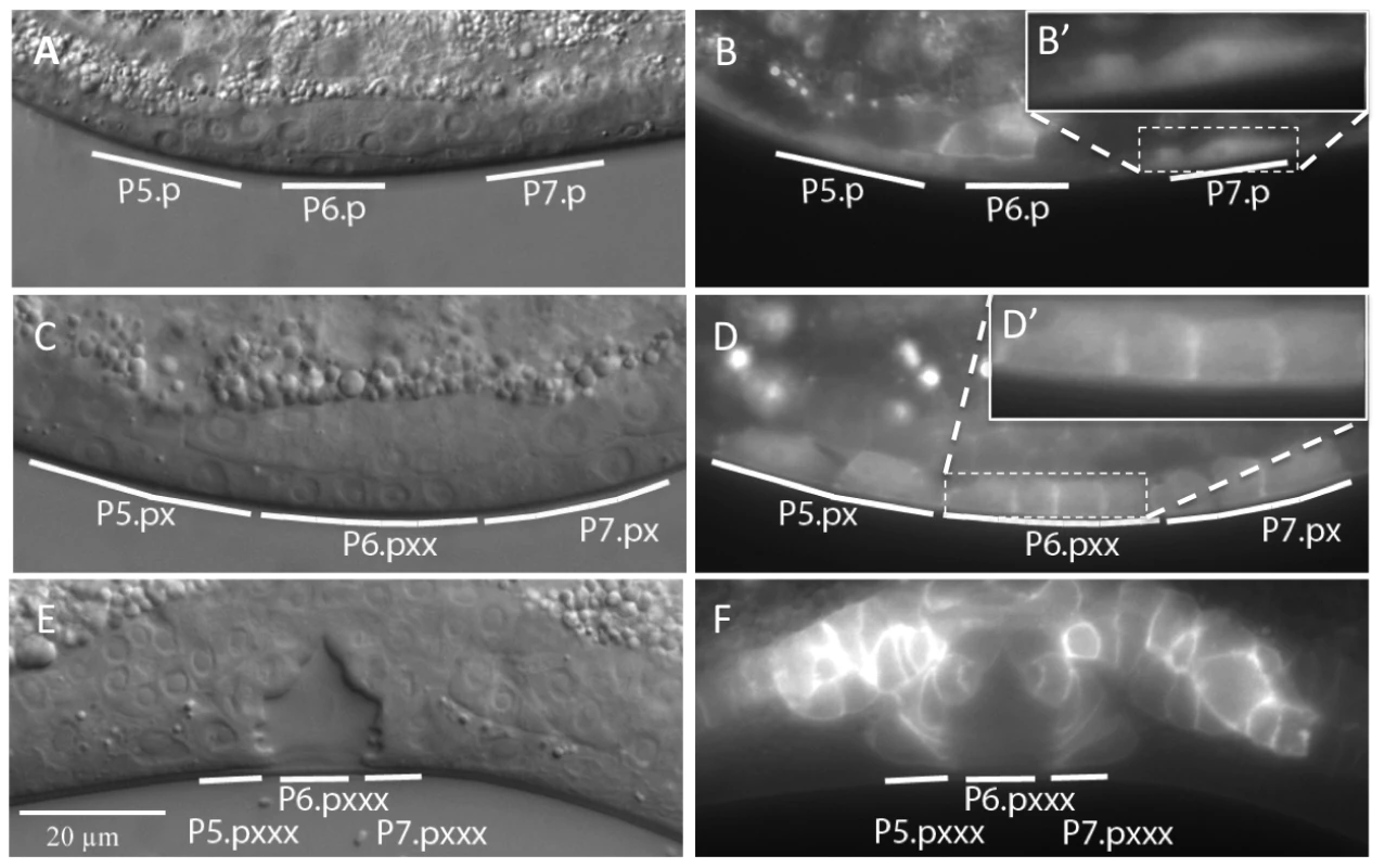 Expression pattern and sub-cellular localization of DAF-18::GFP.