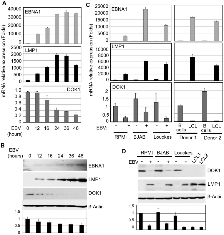 EBV infection in vitro inhibits <i>DOK1</i> gene expression.