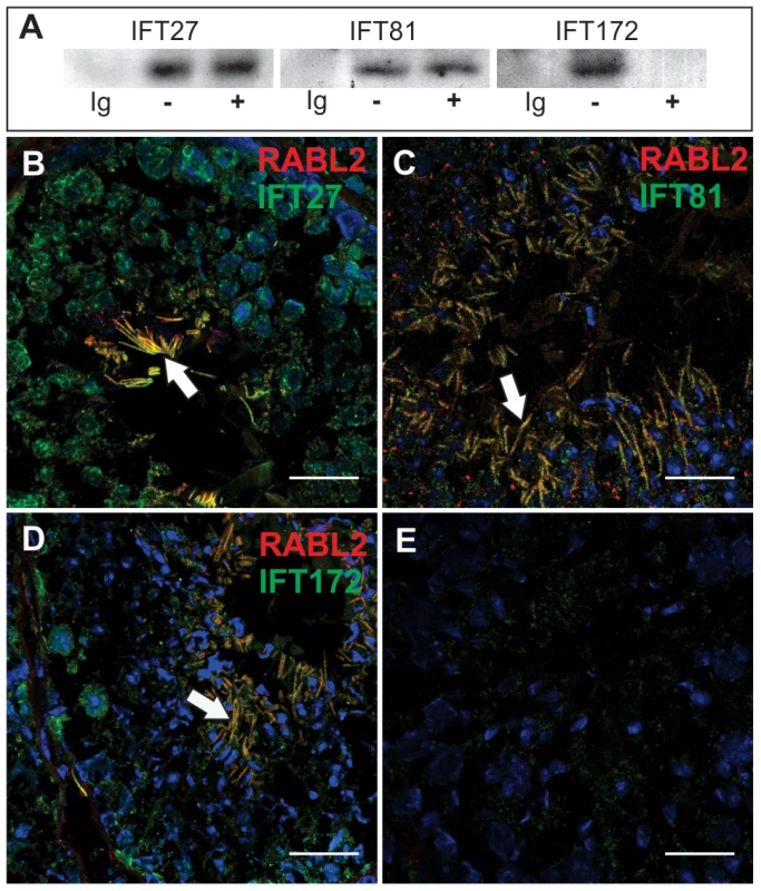 RABL2 binds to components of IFT complex B.