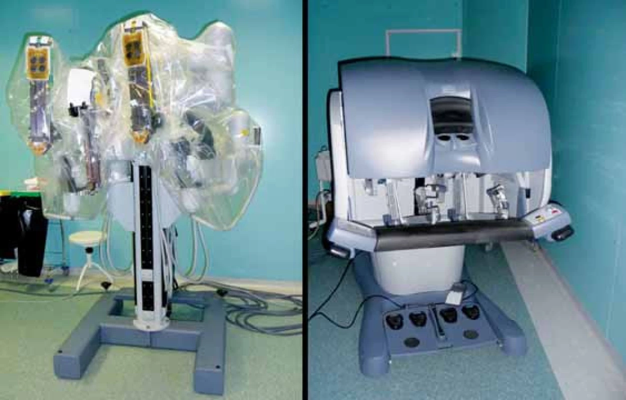 Robotický systém Da Vinci, 3-ramenný
Fig. 1. Three-armed robotic system Da Vinci