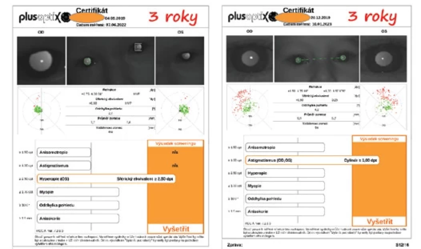 Patologická hodnota astigmatismu na pozitivním certifikátu testu POX k věku dítěte, nutno doplnit zrakovou ostrost – ortoptista nebo zrakový terapeut