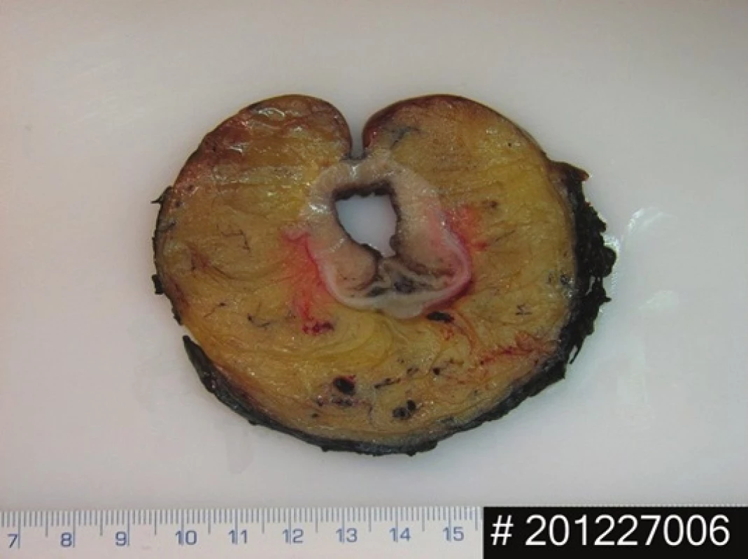 Příklad obsažené fotodokumentace – resekát, příčná lamela
Fig. 5: Example of image documentation – cross-section of the the biopsy cut