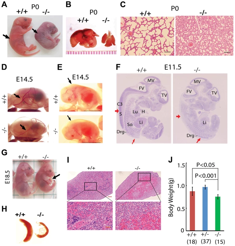 Postnatal lethality and multiple organ defects of <i>Jmjd3</i><sup>−/−</sup> embryos.