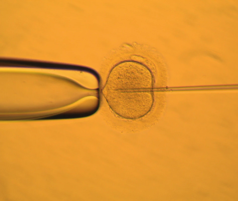 Mikromanipulace – ICSI