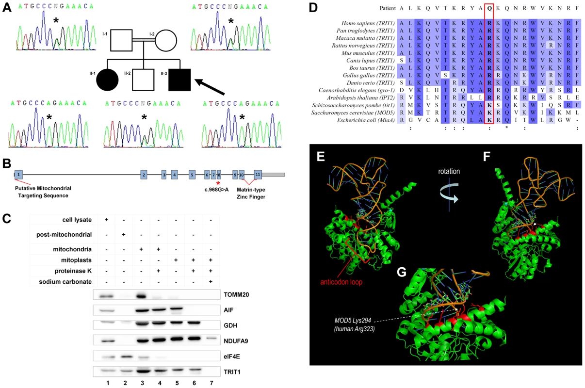A <i>TRIT1</i> mutation segregates with disease and disrupts a conserved tRNA-binding basic side-chain.