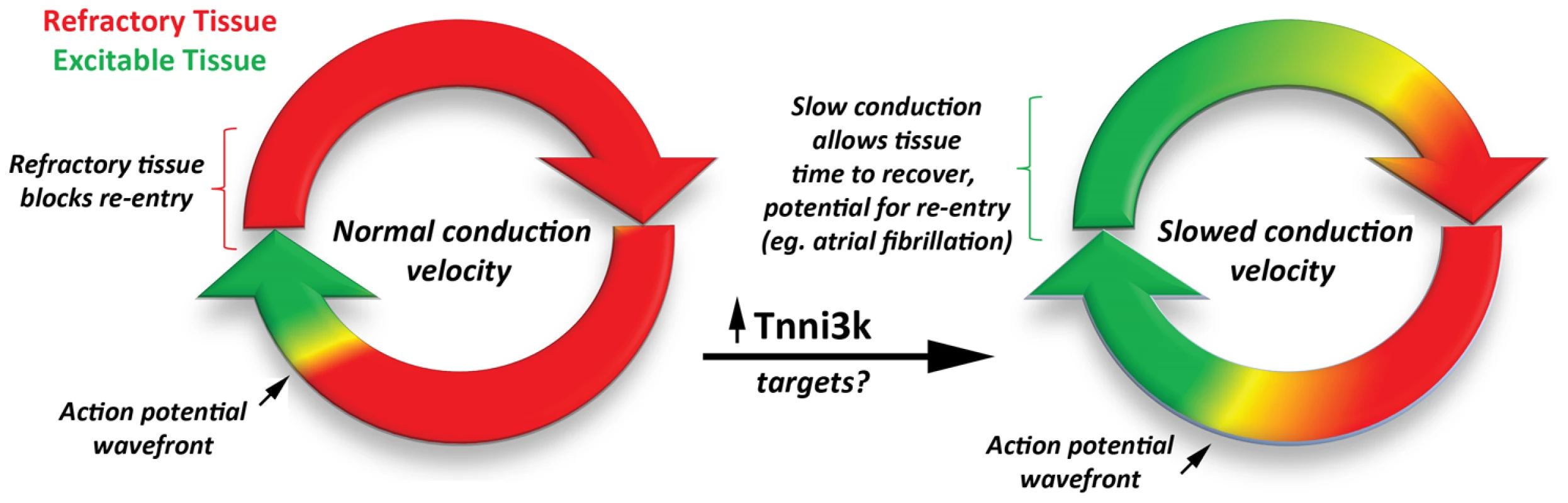 The development of a reentry circuit due to slowed action potential velocity.