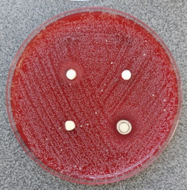 Kultivace Candida albicans, zřetelné inhibiční zóny u materiálů TheraCal LC a Biodentine. Fig. 3 Candida albicans culture, inhibition zones around TheraCal LC, and Biodentine.
