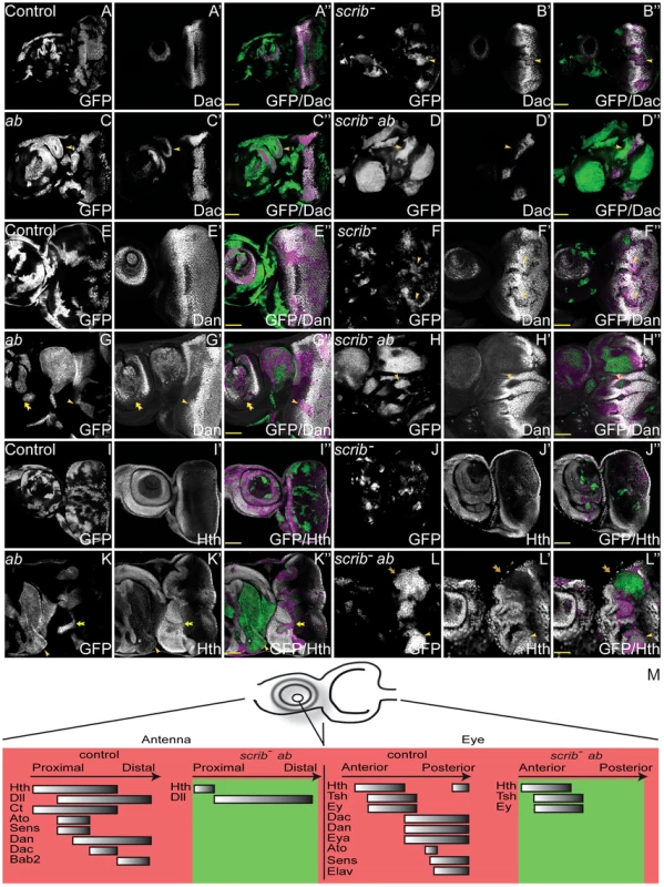 Overexpression of <i>ab</i> in <i>scrib</i> mutant clones promotes the retention of a progenitor-like state in the eye and antennal disc.