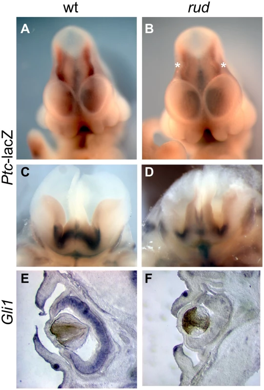 <i>Sonic hedgehog</i> signal transduction is abnormal in <i>rudolph</i> embryonic nervous system and cells.