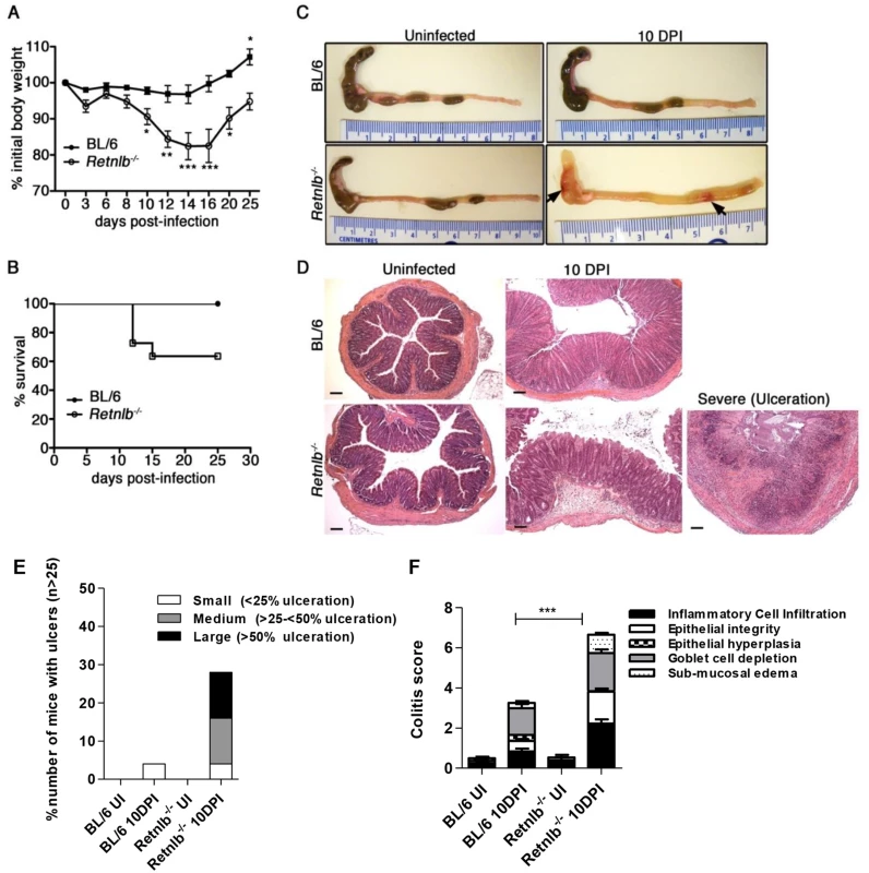 <i>Retnlb</i><sup><i>-/-</i></sup> mice are highly susceptible to <i>C</i>. <i>rodentium</i>-induced colitis.